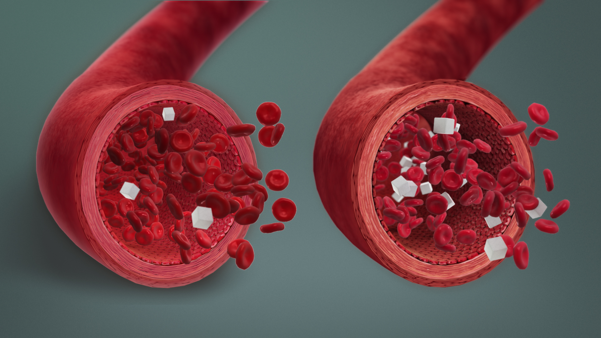 Imagem de referência de hipoglicemia, descrito nos dados abertos como baixas quantidades de glicose no sangue